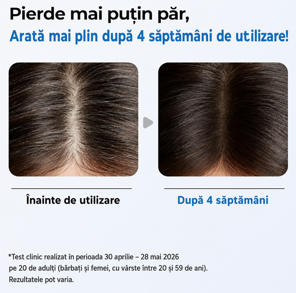 Ser pentru Îngrijirea Scalpului și Susținerea Creșterii Părului